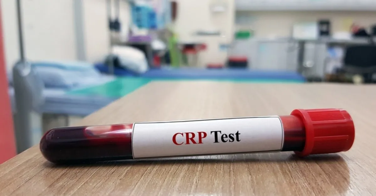 CRP Nedir? Kanda CRP Değeri Yüksekliği Ve Düşüklüğü Ne Anlama Gelir, Normal Değerleri ve Referans Aralığı Kaçtır?
